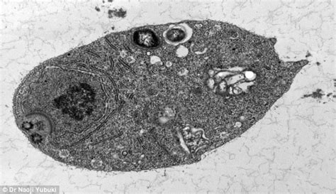  Monocercomonoides: A Microscopic Marvel Lacking Mitochondria That Thrives in Anaerobic Environments!